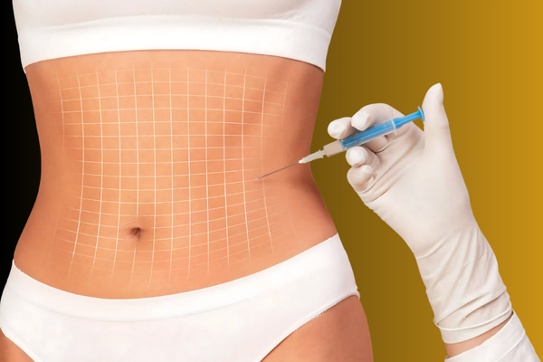 FAT-DISSOLVING INJECTIONS