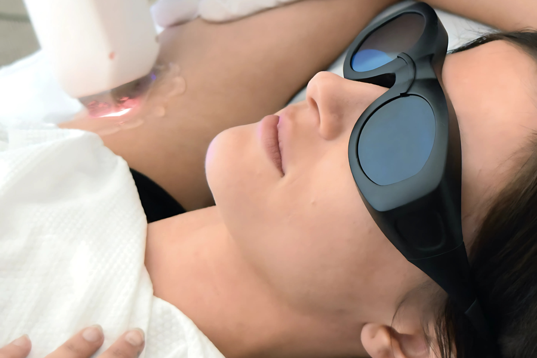 LASER BODY REJUVENATION IN NEWCASTLE (1)